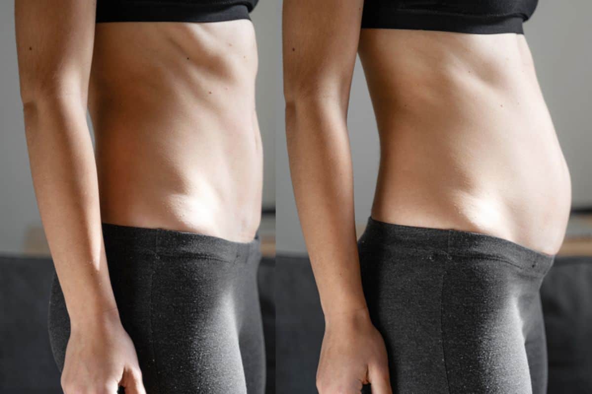 How long does diastasis recti take to improve Coventry?