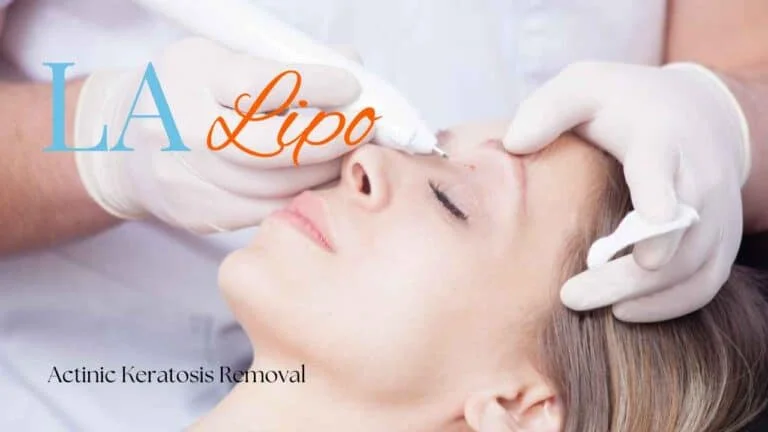 Woman receiving Actinic Keratosis Removal Treatment Coventry