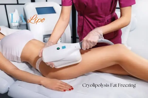 Woman receiving coolsculpting Coventry treatment on her thighs