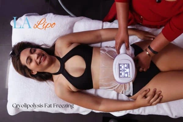woman getting cryolipolysis Coventry