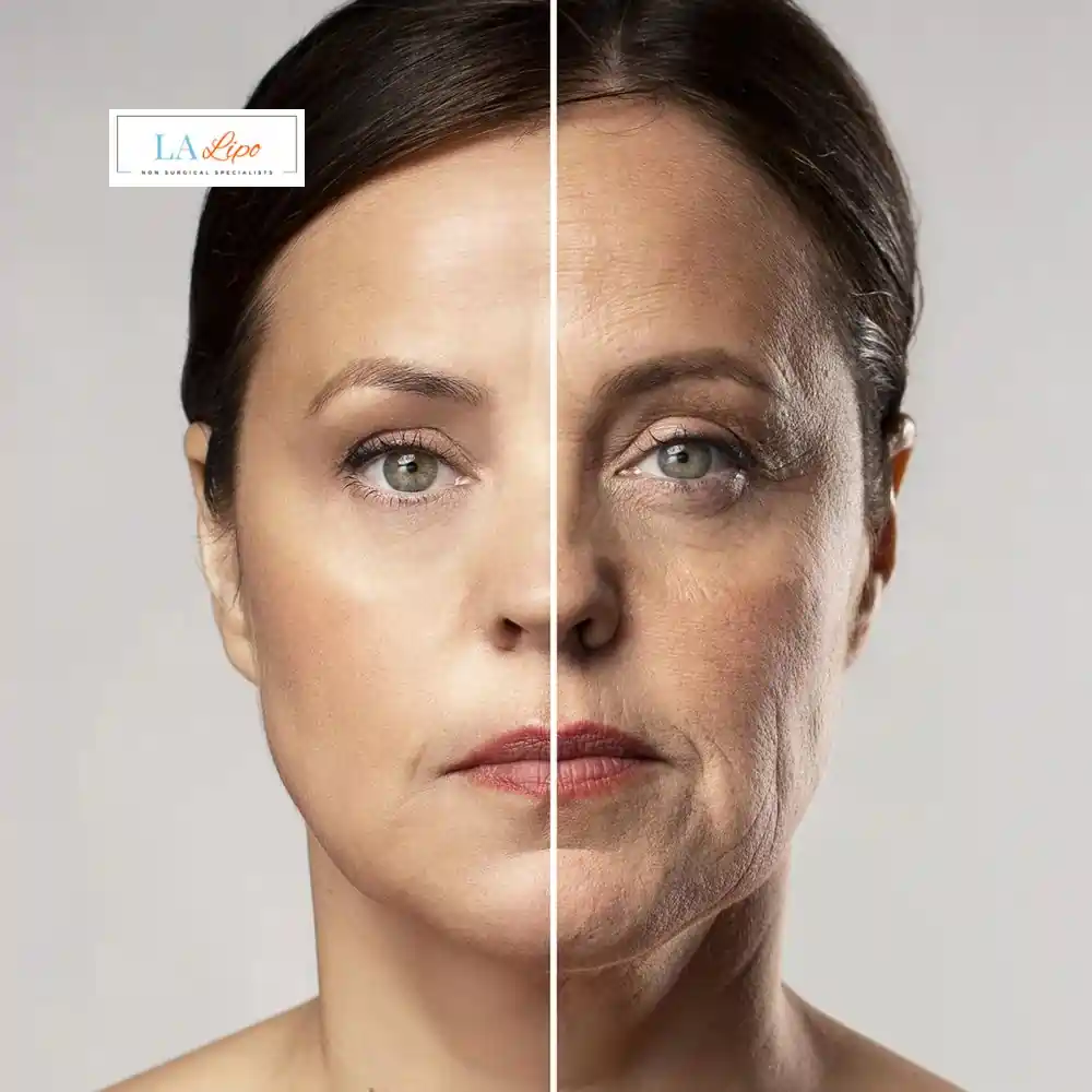 How Can You Tell If Non-Surgical Skin Tightening Is Right for You Coventry?