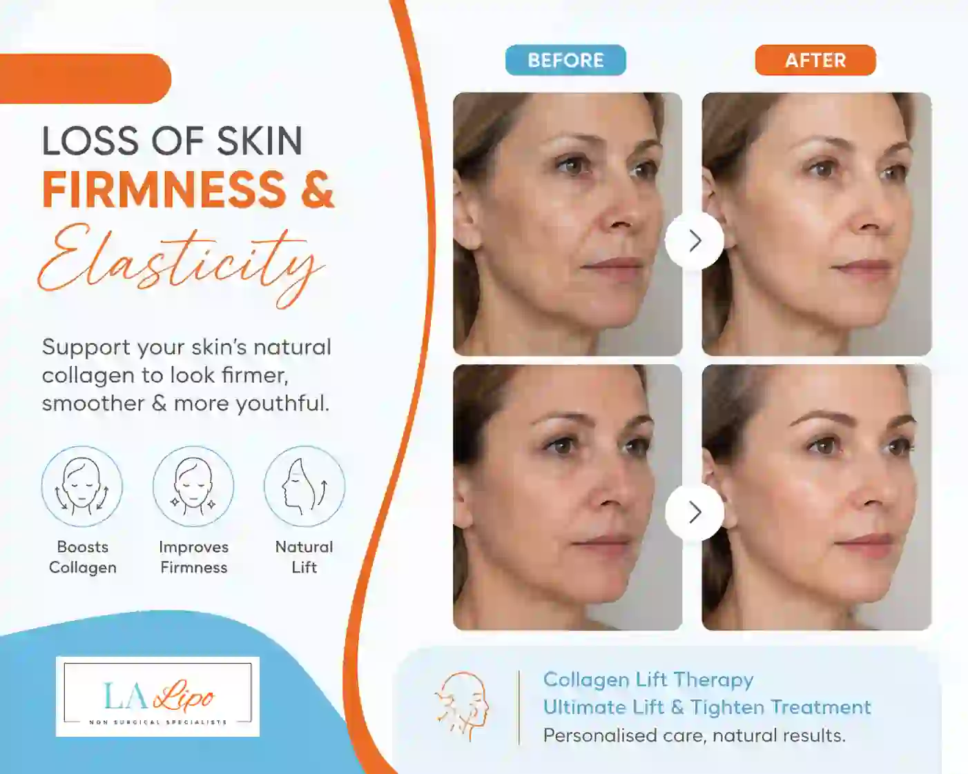 Sign #7: Loss of Skin Firmness and Elasticity Coventry