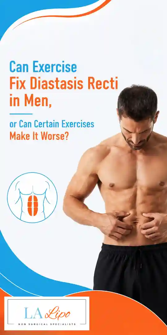Can Exercise Fix Diastasis Recti in Men, or Can Certain Exercises Make It Worse Coventry?